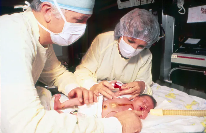 1984 First Infant to Receive an Organ From Another Species