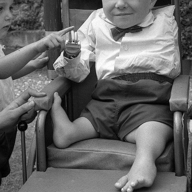 1957 - Thalidomide launched
