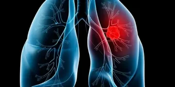 Top 3 deadliest diseases in the world