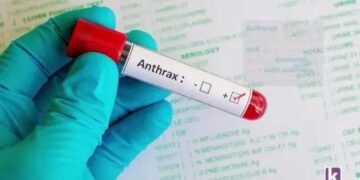 FG alerts public to Anthrax outbreak in Zamfara